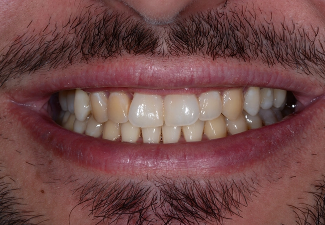 [ASCEND - FAKE] Case 01 - Antes